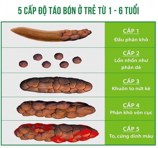 Các lưu ý khi chăm sóc trẻ bị táo bón - Ảnh 2.