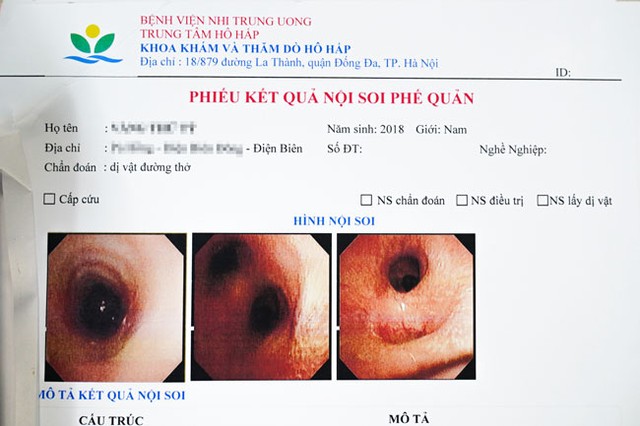 Con đỉa sống trong khí quản em bé 4 tuổi sau tắm suối - Ảnh 1.