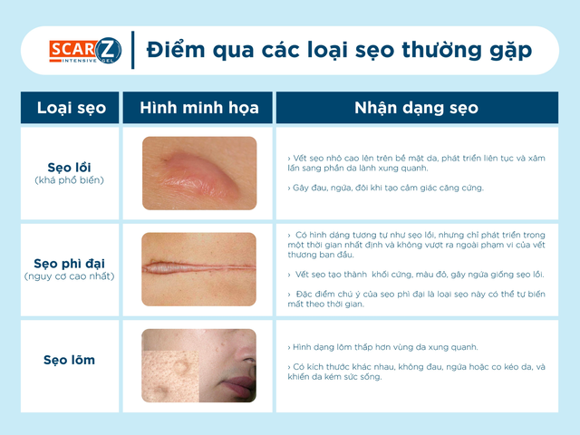 Từ chuyên gia trị sẹo: 4 tuần – 2 lời khuyên giúp lành sẹo hiệu quả - Ảnh 1.