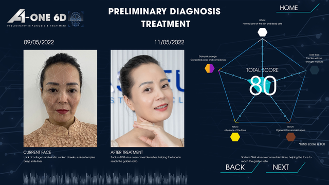 Công nghệ tái cấu trúc ngoại vi giúp khuôn mặt đầy đặn và cân đối - Ảnh 1.