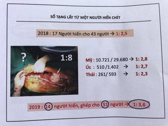 6.550 ca ghép tạng tại Việt Nam trong 30 năm qua - những khó khăn và thách thức  - Ảnh 6.