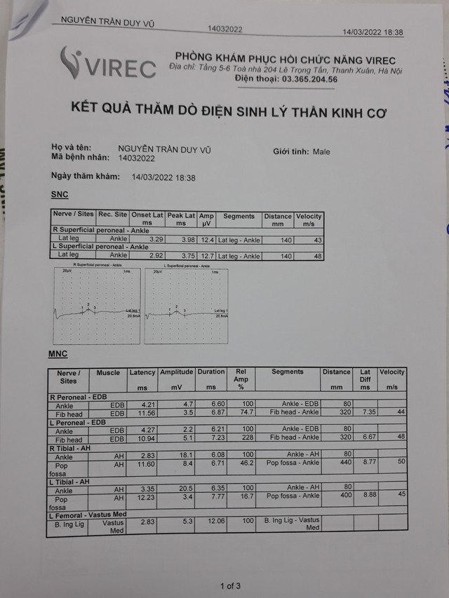 Cảnh báo tình trạng thoát vị đĩa đệm ở người trẻ! - Ảnh 2.