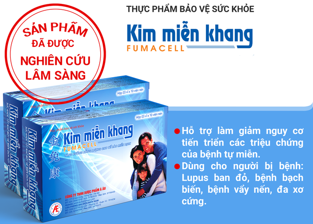 Triệu chứng và cách hỗ trợ giảm nguy cơ tiến triển bệnh lupus ban đỏ - Ảnh 3.