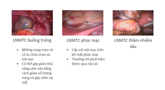 Bayer đồng hành cùng phụ nữ Việt Nam trong Chương trình chung tay vì cộng đồng bệnh nhân lạc nội mạc tử cung - Ảnh 4.