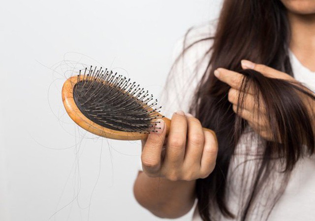 ‏6 nguyên nhân gây rụng tóc và cách khắc phục‏ - Ảnh 2.
