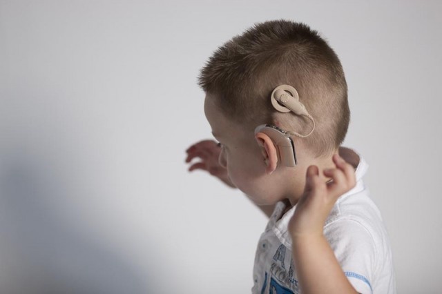 Khiếm thính trẻ nhỏ - Phát hiện, can thiệp sớm để phát triển hoàn thiện - Ảnh 4.