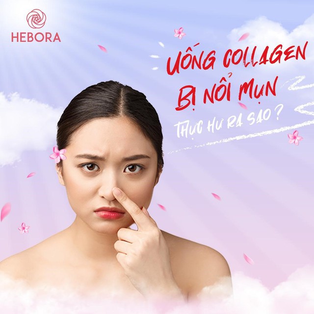 Sự thật cần biết về collagen trước khi sử dụng - Ảnh 3.