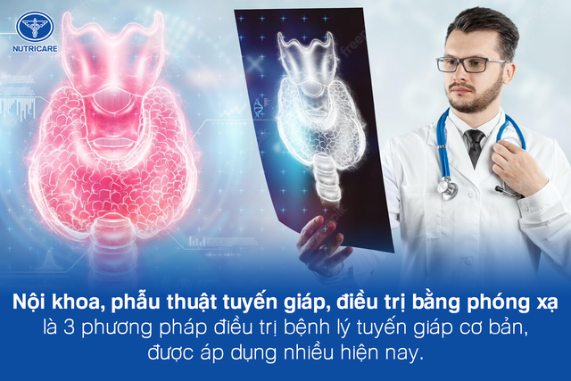 Những lưu ý trong quá trình điều trị bệnh tuyến giáp - Ảnh 3.