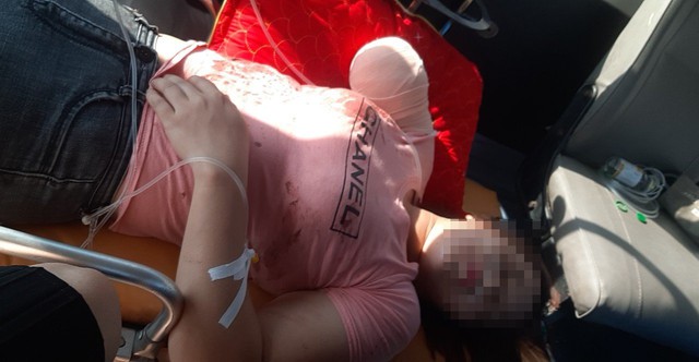 Gia cảnh đáng thương của người phụ nữ bị đứt lìa cánh tay trong vụ lật xe chở công nhân ở Bắc Giang - Ảnh 2.