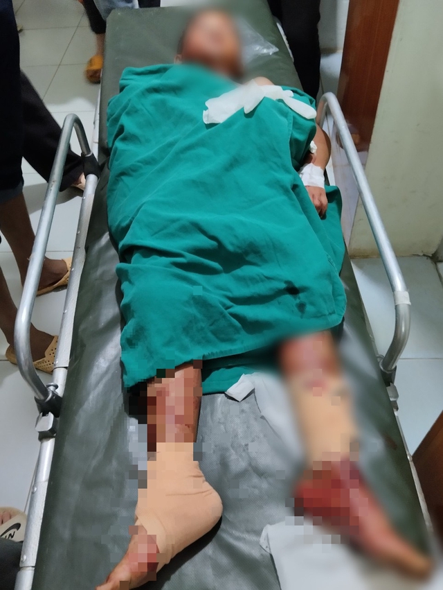 2 cháu bé trong vụ nổ bom bi tại Sơn La đã qua nguy kịch - Ảnh 3.