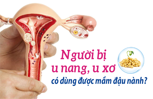 Bị u có dùng được mầm đậu nành không? - Ảnh 1.