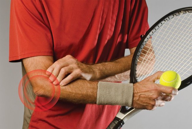 Gọi là hội chứng khủyu tay quần vợt vì có đến khoảng 1/3 tổng số người bị chứng đau này của khuỷu khi chơi quần vợt.