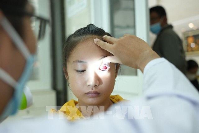 Hà Nội yêu cầu triển khai các biện pháp chống lây nhiễm đau mắt đỏ tại nhà trẻ, trường học... - Ảnh 1.