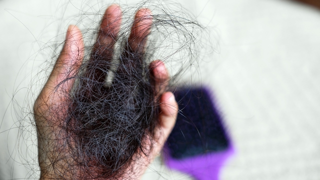 3 cách làm giảm rụng tóc tại nhà - Ảnh 2.