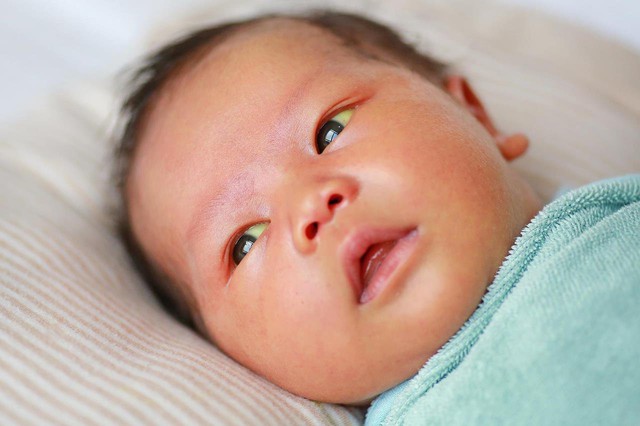 Nhận biết những dấu hiệu nguy hiểm ở trẻ sơ sinh- Ảnh 3.