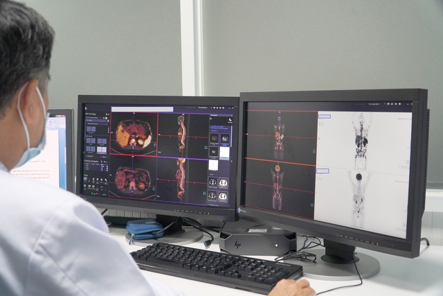 Lần đầu tiên Việt Nam pha chế thành công 2 loại thuốc phóng xạ mới để thực hiện ghi hình PET/CT- Ảnh 1.
