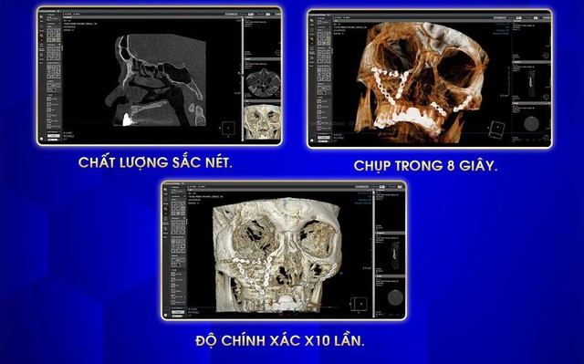 Top 6 dáng mũi đẹp trở thành &quot;hot trend&quot; trong năm 2023 Quý Mão - Ảnh 4.