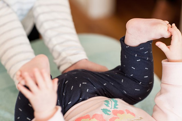 Phát hiện loạn sản khớp háng tiến triển (DDH) ở trẻ sơ sinh đến sáu tháng tuổi - Ảnh 1.