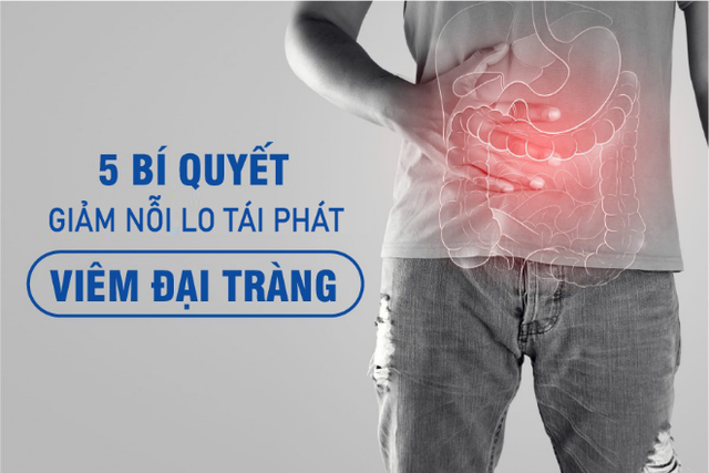 Giải pháp giảm nguy cơ tái phát viêm đại tràng - Ảnh 1.