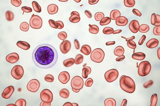 Thiếu máu nhược sắc là tình trạng xuất hiện sự suy giảm số lượng huyết sắc tố trong tế bào, kích thước hồng cầu biến đổi và nhạt màu hơn bình thường.