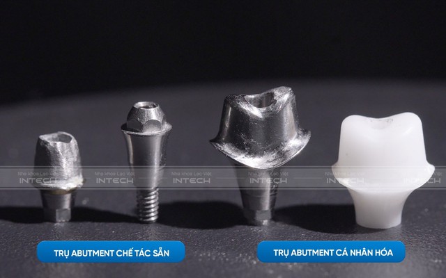 Ưu điểm vượt trội của công nghệ phục hình răng sứ trên implant DCT - Ảnh 1.