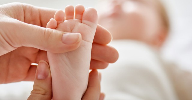 Bàn chân khoèo bẩm sinh ở trẻ: Nhận biết, nguyên nhân và điều trị - Ảnh 2.