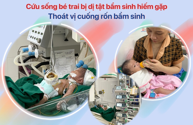 Cứu sống trẻ sơ sinh bị thoát vị cuống rốn phức tạp - Ảnh 2.