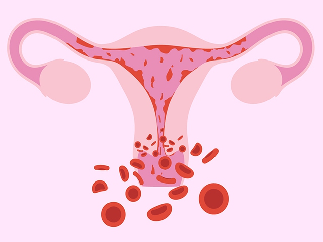 Rong kinh không được điều trị ảnh hưởng đến khả năng sinh sản của phụ nữ - Ảnh 2.