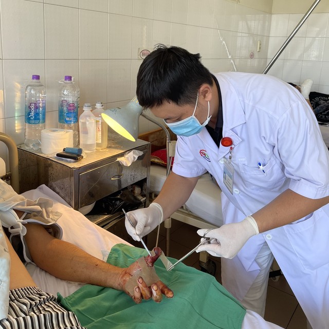 Ông T.T.B (tổ dân phố 2, thị trấn Vạn Giã, huyện Vạn Ninh, Khánh Hòa) suýt mất 3 ngón tay do tai nạn lao động do bất cẩn.