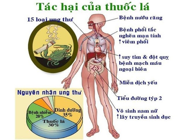 Nhiều người ung thư phổi, đột quỵ não do tác hại của thuốc lá - Ảnh 3.