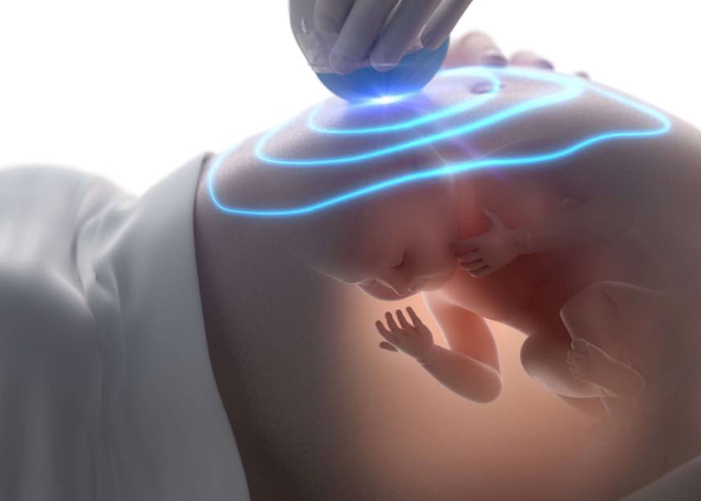 Khám sàng lọc trước sinh sẽ giúp phát hiện sớm những dị tật bẩm sinh liên quan đến bất thường nhiễm sắc thể mà thai nhi có thể gặp phải như hội chứng Down, Edwards, Patau,...
