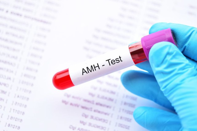 AMH (Anti-Mullerian Hormone) là một hormon được tiết ra từ tế bào nang buồng trứng của phụ nữ.