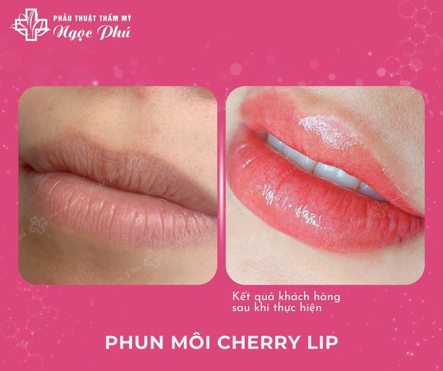 Phun môi Cherry Lip vừa ra mắt đã trở thành xu hướng - Ảnh 2.