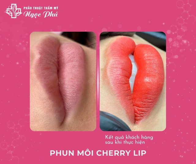 Phun môi Cherry Lip vừa ra mắt đã trở thành xu hướng - Ảnh 3.