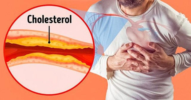 7 loại thức uống hạn chế cholesterol đảm bảo chất lượng cho tất cả những người tăng mỡ tiết  - Hình ảnh 3.