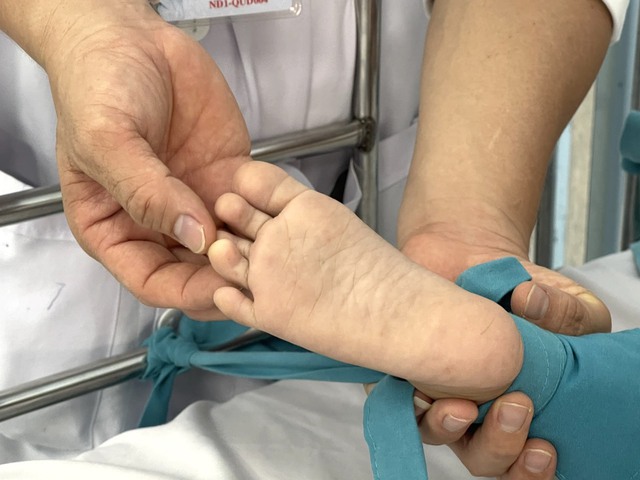 Bệnh tay chân miệng: Cha mẹ bình tĩnh, không phải cứ đưa trẻ lên TP.HCM là tốt nhất - Ảnh 1.