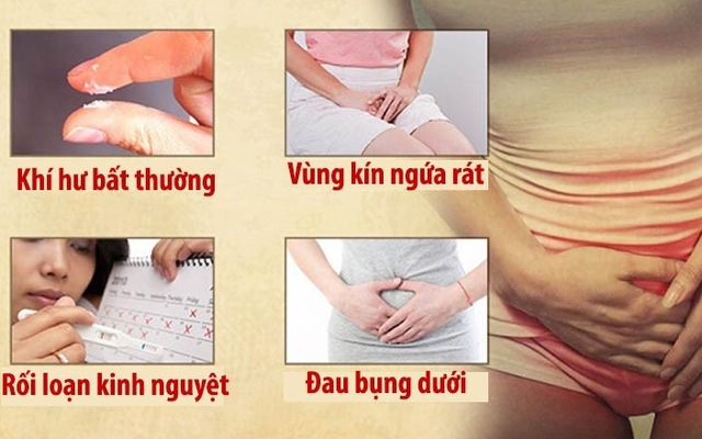 ‘Vùng kín’ tiết dịch - Khi nào là bất thường? - Ảnh 4.