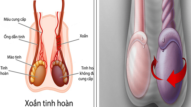 Nam thanh niên cần cảnh giác kẻo 'của quý'... hỏng - Ảnh 1.