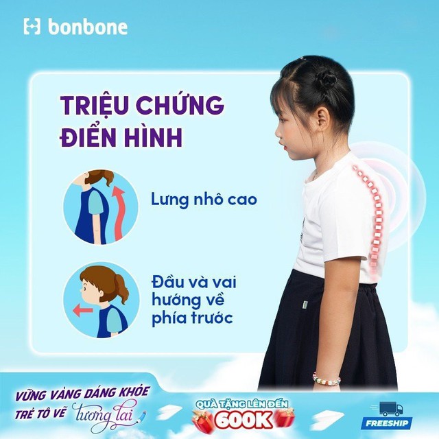 Bệnh học đường: Cha mẹ cần làm gì khi trẻ có dấu hiệu cong vẹo cột sống? - Ảnh 2.