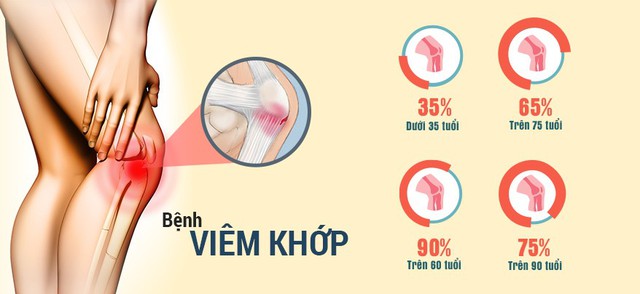 Thực phẩm chức năng hỗ trợ xương khớp nào được người Nhật tin dùng? - Ảnh 1.