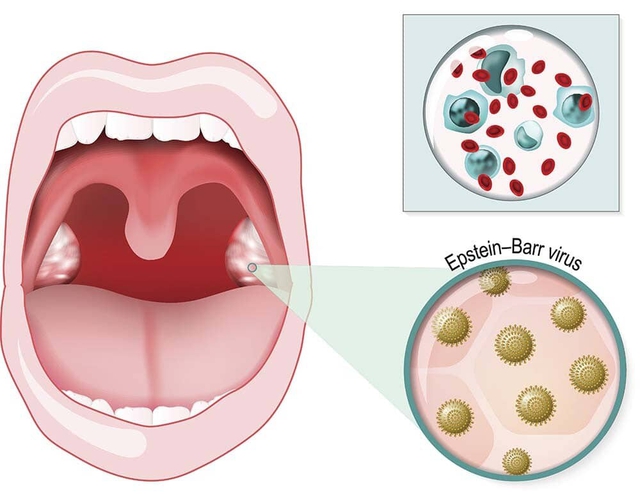 Một số bệnh do virus có thể lây truyền qua nụ hôn- Ảnh 1.