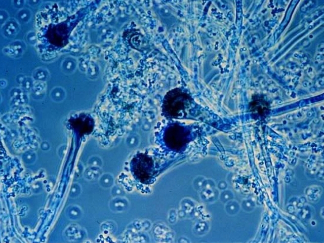 Hình ảnh nấm phổi dưới kính hiển vi.