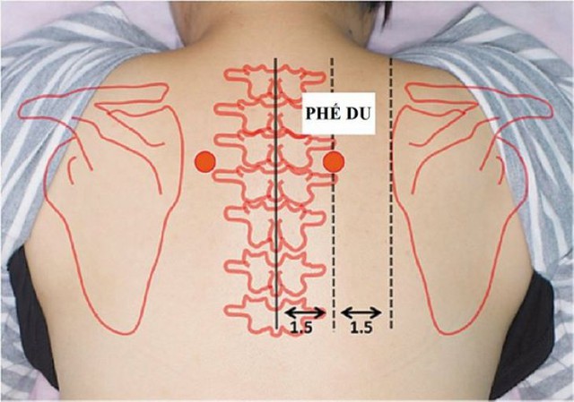 
Giảm đau cổ vai gáy bằng các phương pháp đơn giản tại nhà - Ảnh 4.