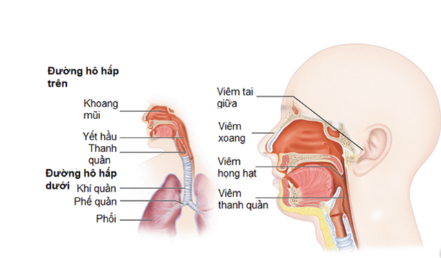 Chế độ ăn cho người bệnh viêm đường hô hấp trên- Ảnh 3.