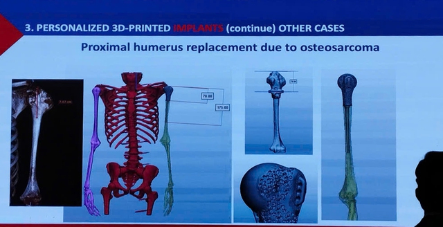 Công nghệ in 3D dần được ứng dụng rộng rãi trong khám, chữa bệnh- Ảnh 3.