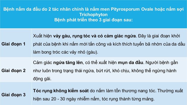 Nấm da đầu là gì? Nguyên nhân & cách cải thiện hiệu quả- Ảnh 1.