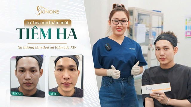 SkinOne tiên phong tạo hình HA trẻ hóa- Ảnh 2.