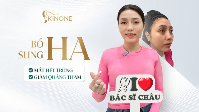 SkinOne tiên phong tạo hình HA trẻ hóa- Ảnh 3.