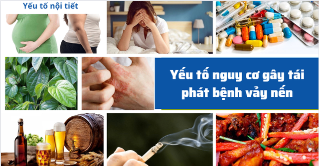 Vảy nến khó kiểm soát, dễ tái phát - Hiểu nguyên nhân sẽ biết cách xử lý- Ảnh 2.