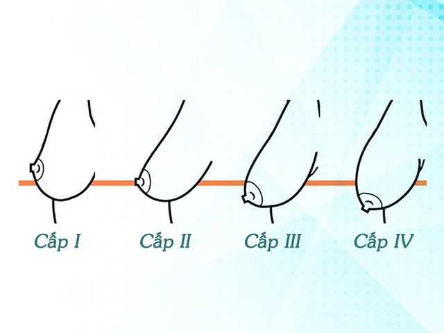 4 hiểu lầm phổ biến khi treo sa trễ ngực- Ảnh 1.